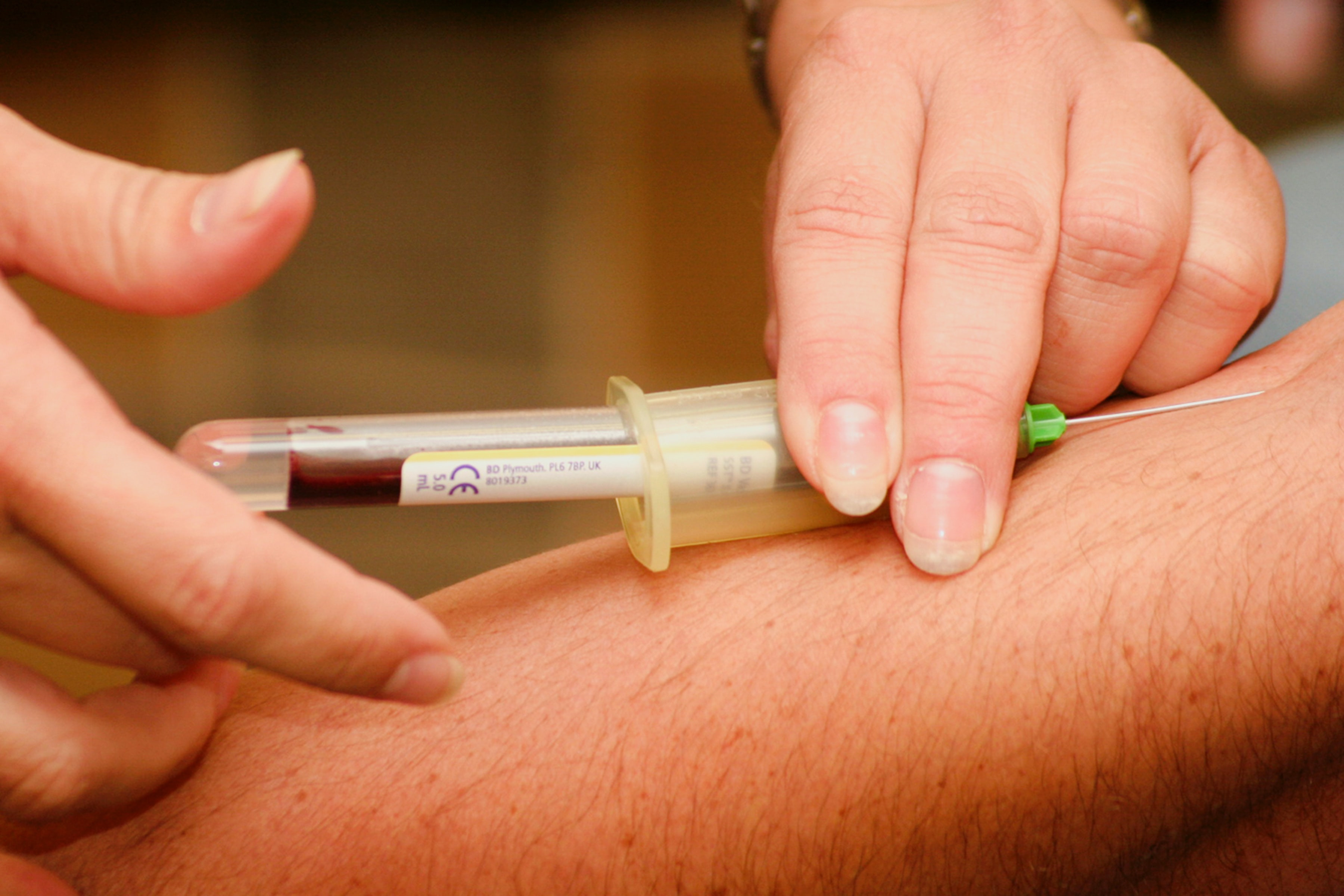 close-up image of someone having their blood taken by a medical professional 